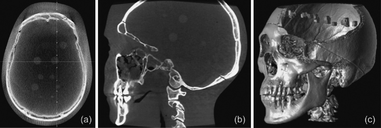 SHIMADZU CORPORATION : Dynamic Digital Radiology Added to Mobile X-Ray  System Acquiring Dynamic X-Ray Images Helps Diagnose Patients who are  Difficult to Move