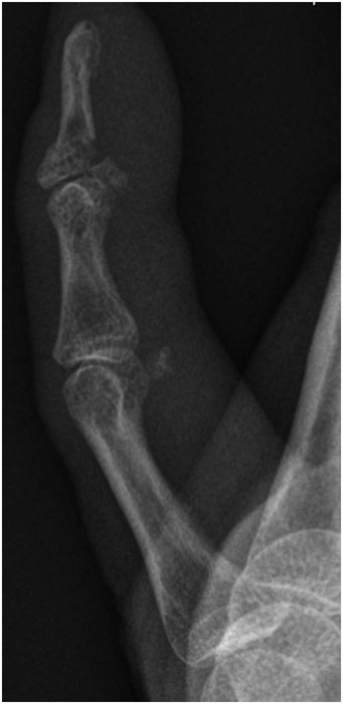 The hand and upper limb oral (Section 5) - Postgraduate Orthopaedics
