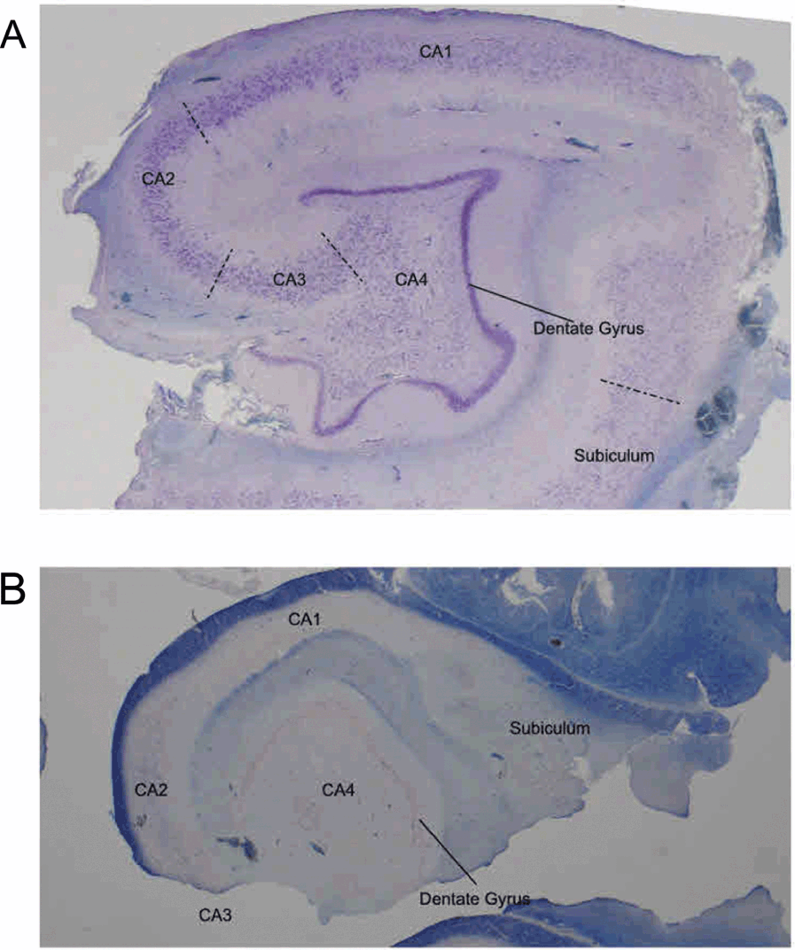 Imaging the Development and Early Phase of the Disease Part I