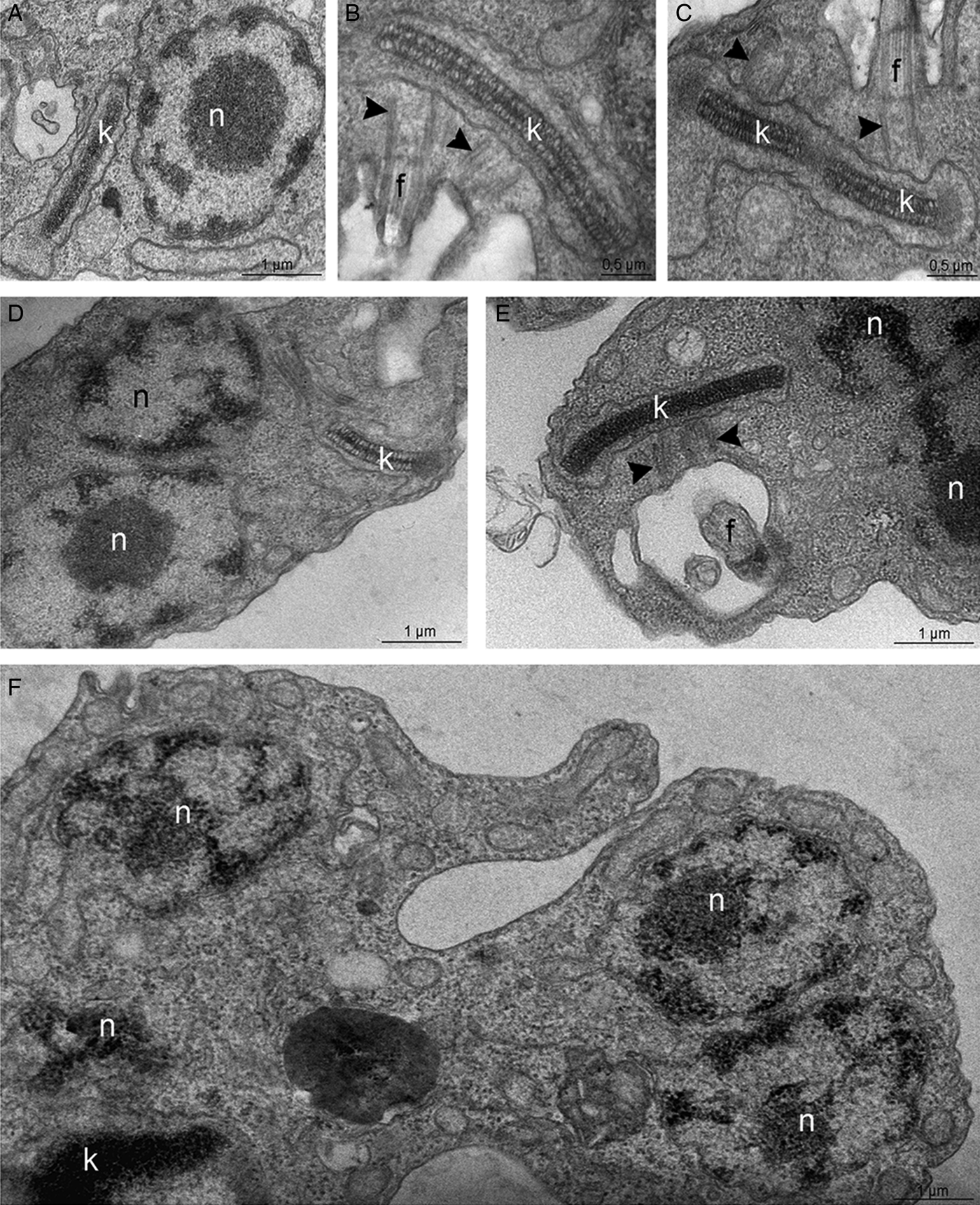 Trichostatin A induces Trypanosoma cruzi histone and tubulin acetylation:  effects on cell division and microtubule cytoskeleton remodelling |  Parasitology | Cambridge Core