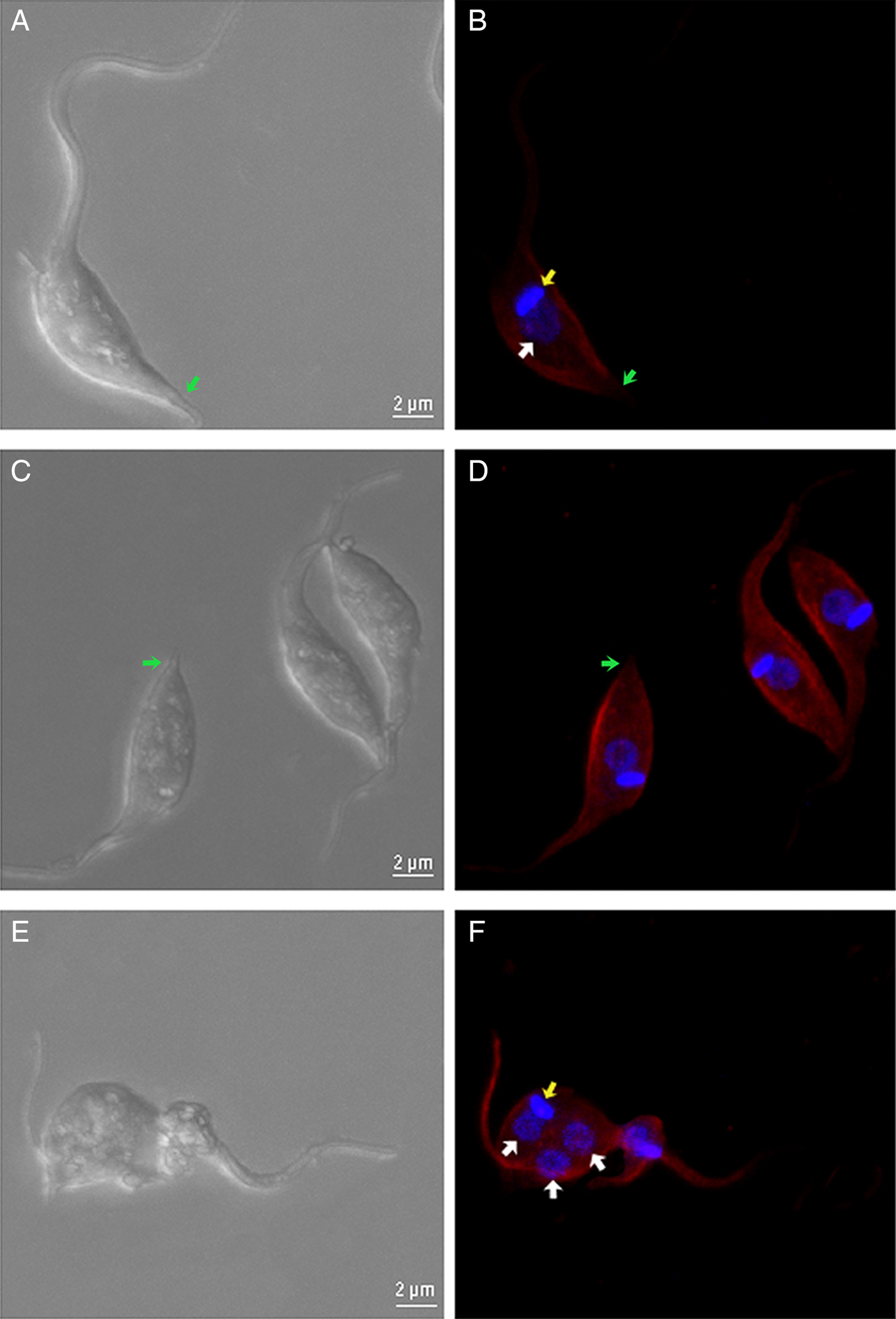 Trichostatin A Induces Trypanosoma Cruzi Histone And Tubulin Acetylation Effects On Cell Division And Microtubule Cytoskeleton Remodelling Parasitology Cambridge Core