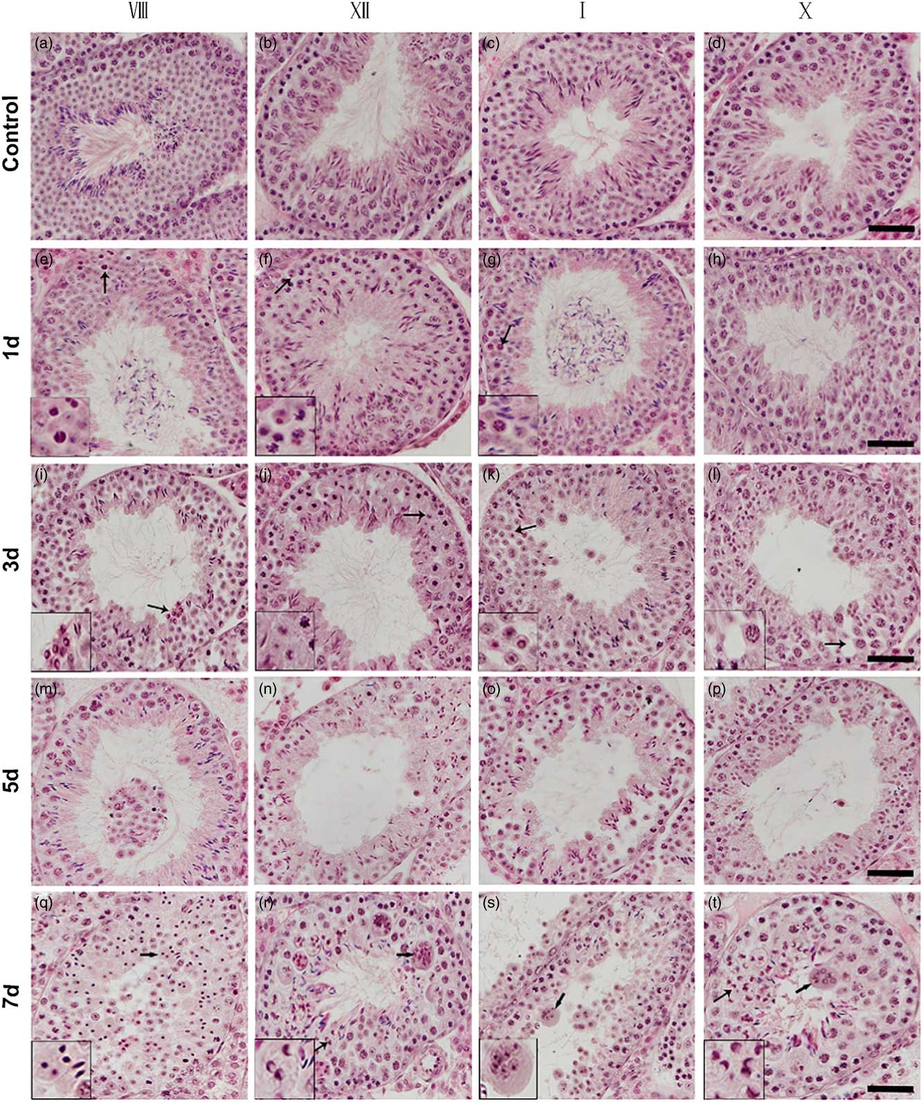 Surgery-induced cryptorchidism induces apoptosis and autophagy of ...