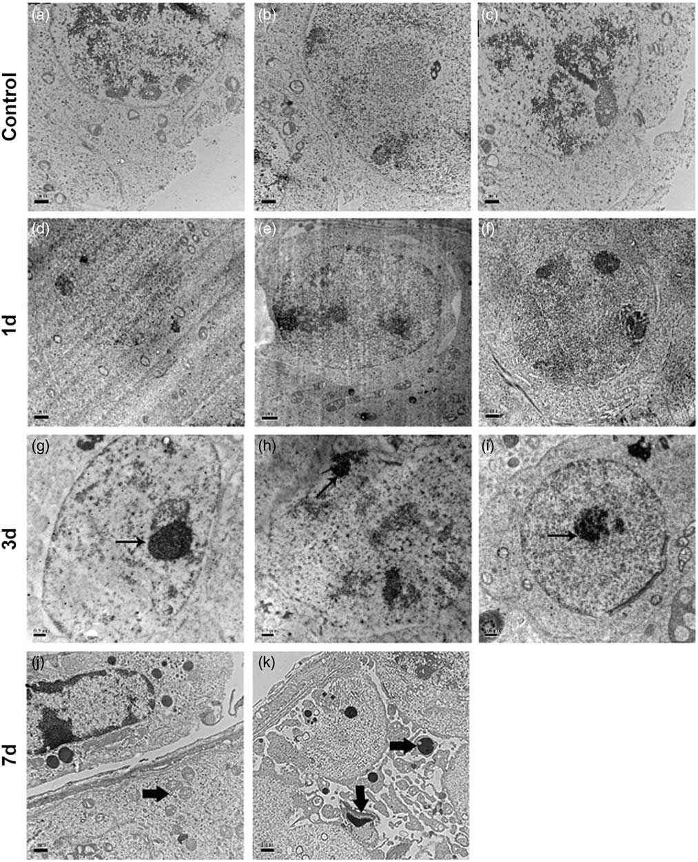 Temperature sensitivity of DNA double-strand break repair underpins  heat-induced meiotic failure in mouse spermatogenesis