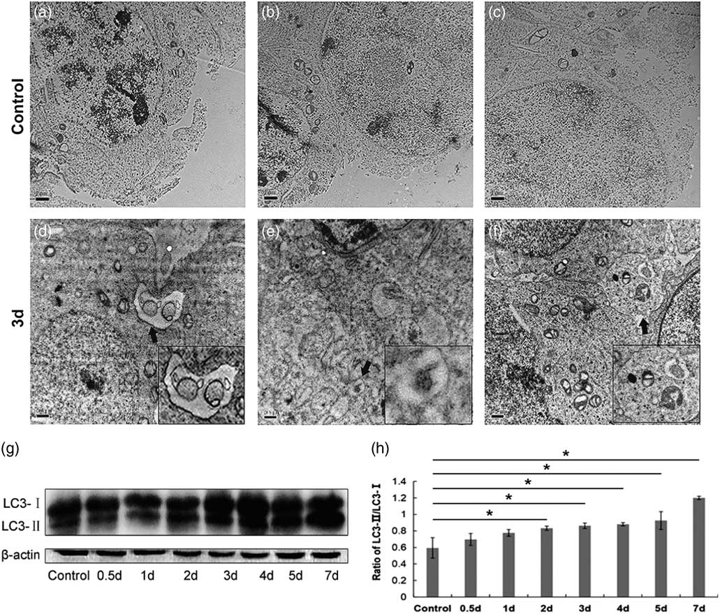 Surgery-induced cryptorchidism induces apoptosis and autophagy of