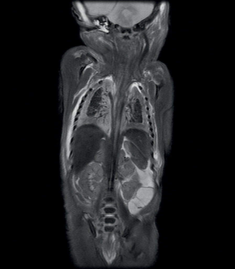 Autopsy imaging 症例集 第2巻 | dizmekaro.com