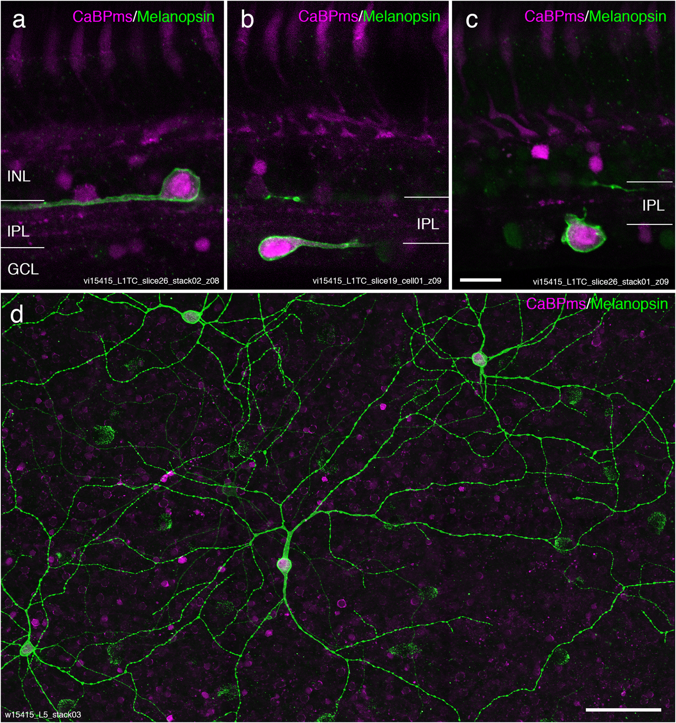 Frontiers  Intrinsically Photosensitive Retinal Ganglion Cells of the  Human Retina