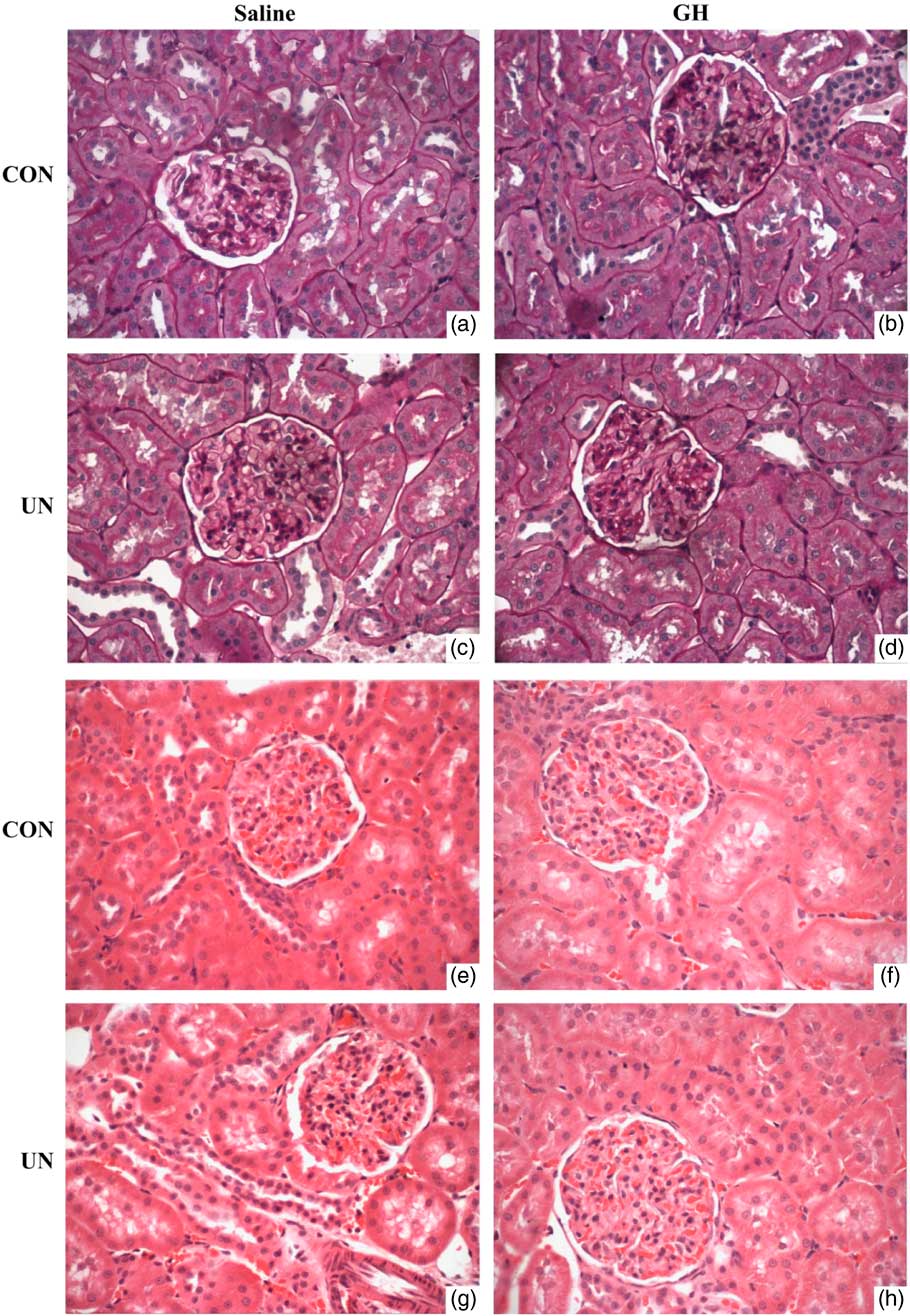 Maternal Undernutrition Results In Altered Renal Pro Inflammatory Gene Expression Concomitant With Hypertension In Adult Male Offspring That Is Ameliorated Following Pre Weaning Growth Hormone Treatment Journal Of Developmental Origins Of Health And