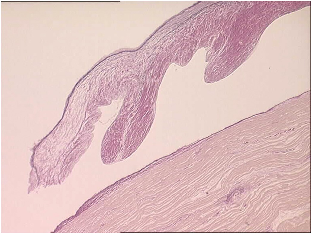 atrioventricular valve histology