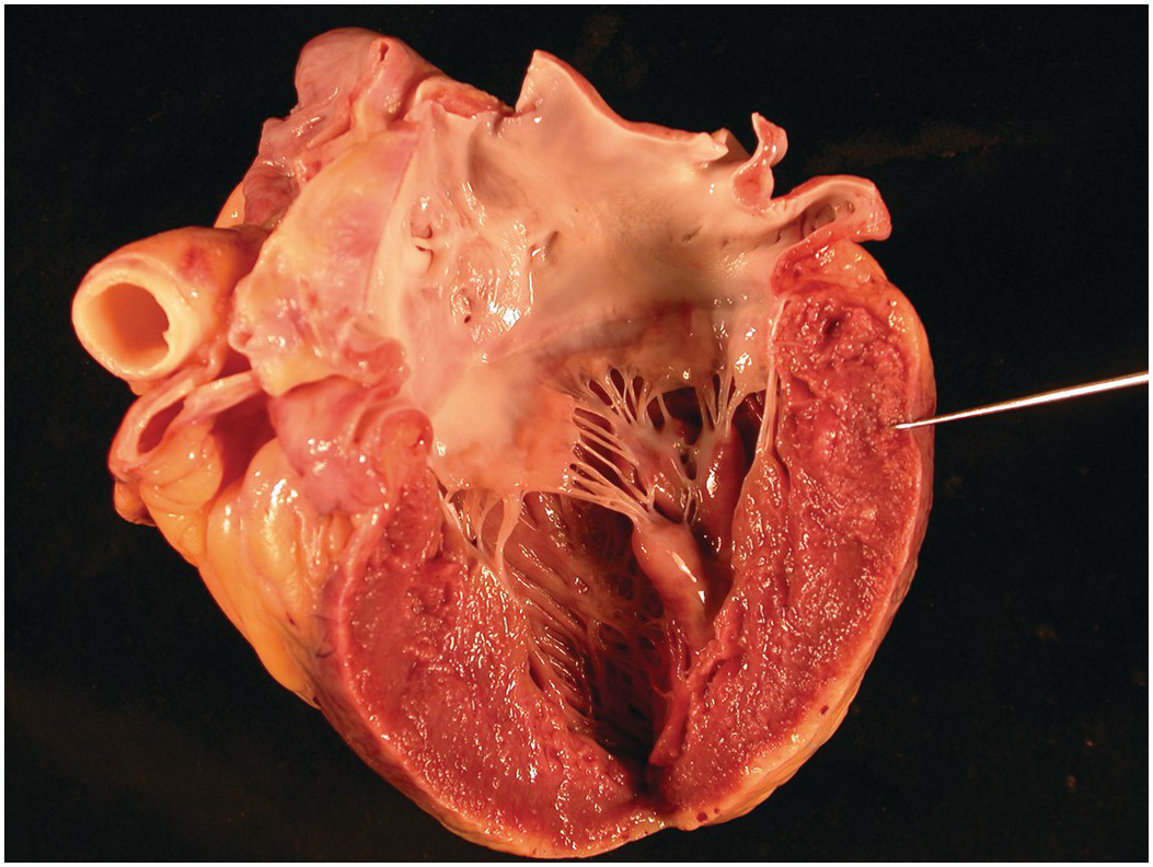 heart histology atrium