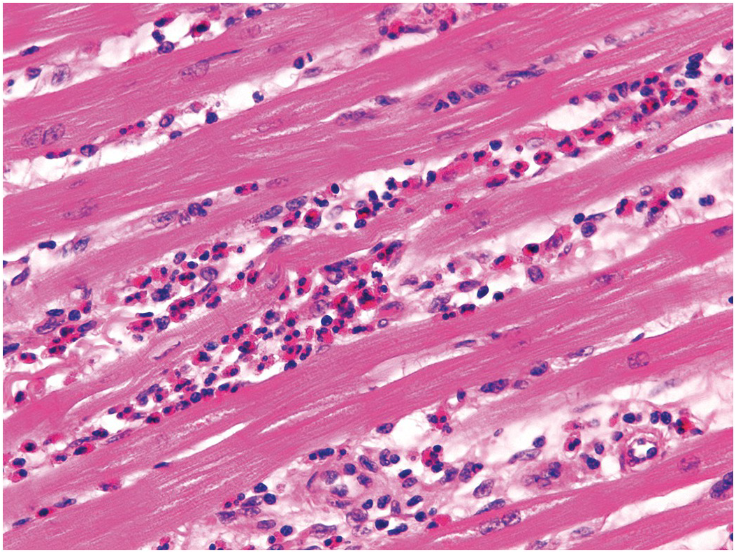 Cardiac muscle - Wikipedia, image size:1053x792