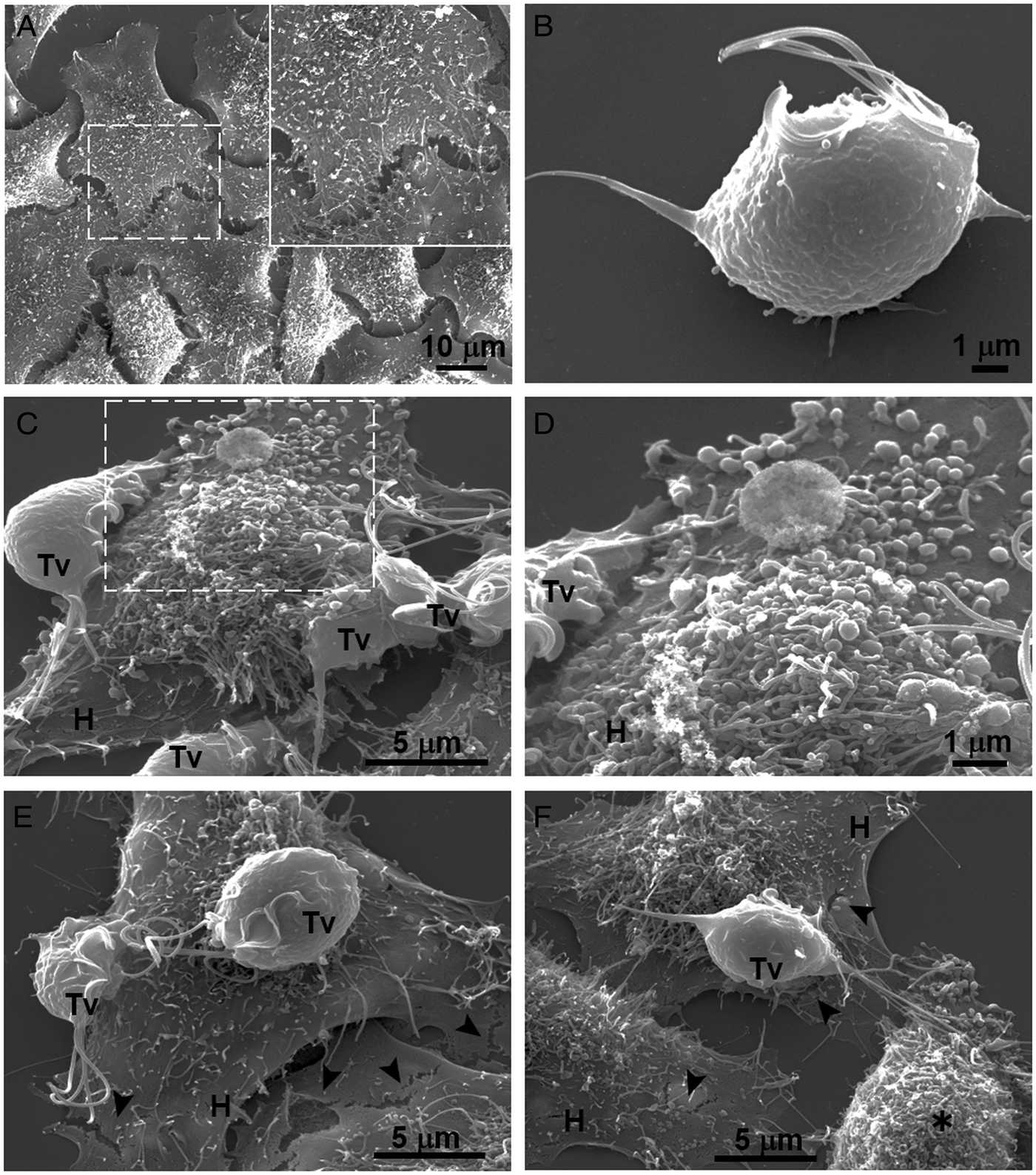 Glucose-restriction increases Trichomonas vaginalis cellular damage towards  HeLa cells and proteolytic activity of cysteine proteinases (CPs), such as  TvCP2 | Parasitology | Cambridge Core