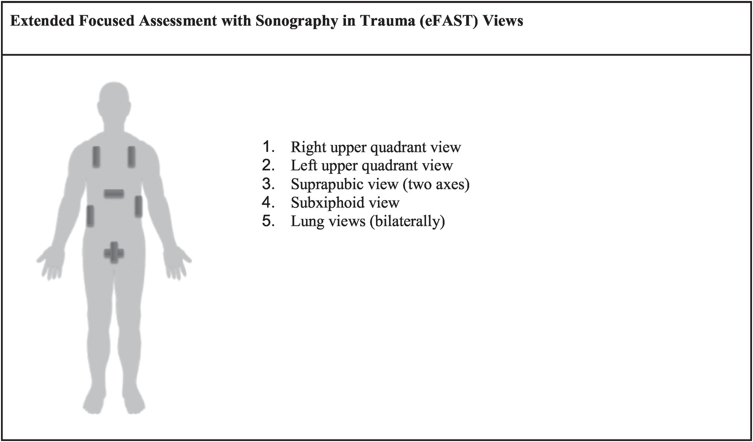 Extended focussed assessment by sonography in trauma (eFAST) scan