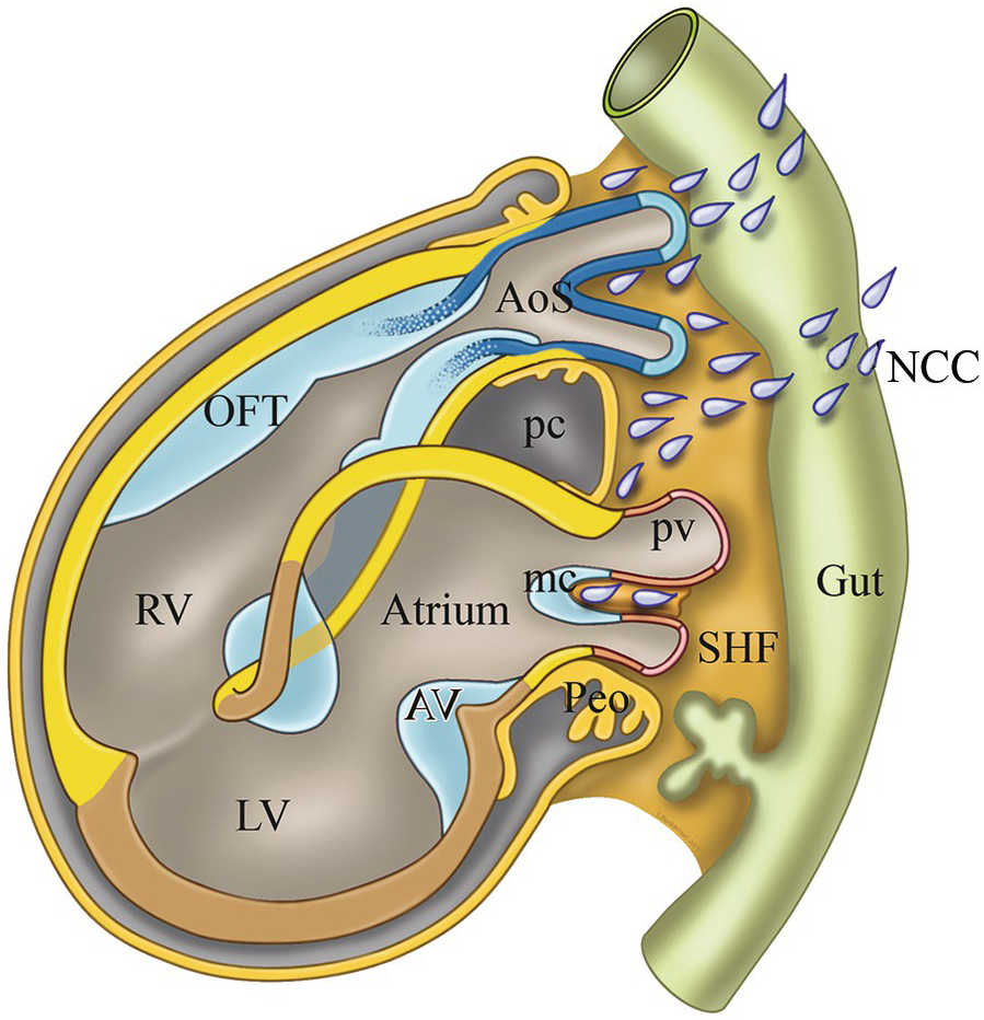 Structural Heart Disease In The Fetus Fetal Therapy