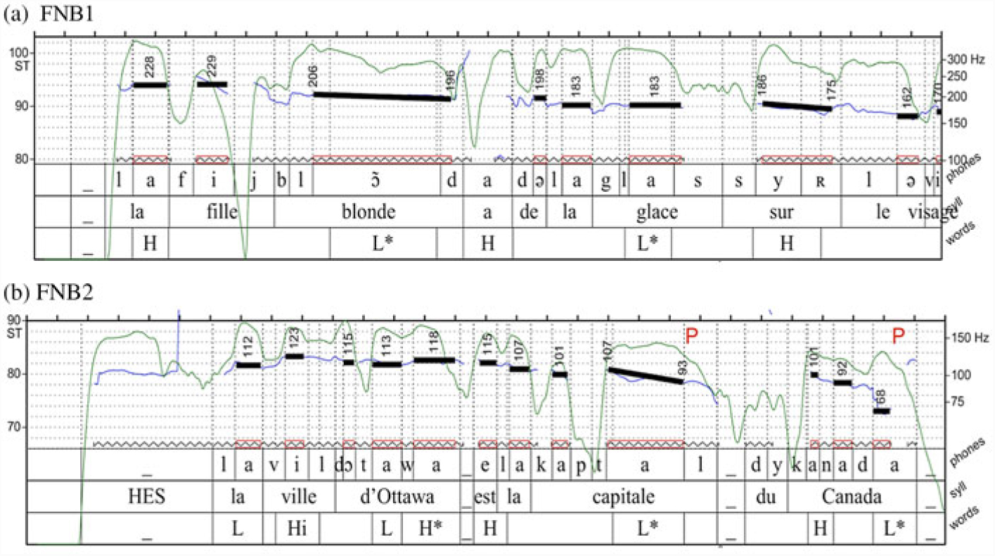 L Intonation Du Francais Au Canada Etude De Cas Des Patrons Intonatifs Et Des Syllabes Accentuees Dans Les Varietes Parlees Au Nouveau Brunswick Et Au Quebec Journal Of French Language Studies