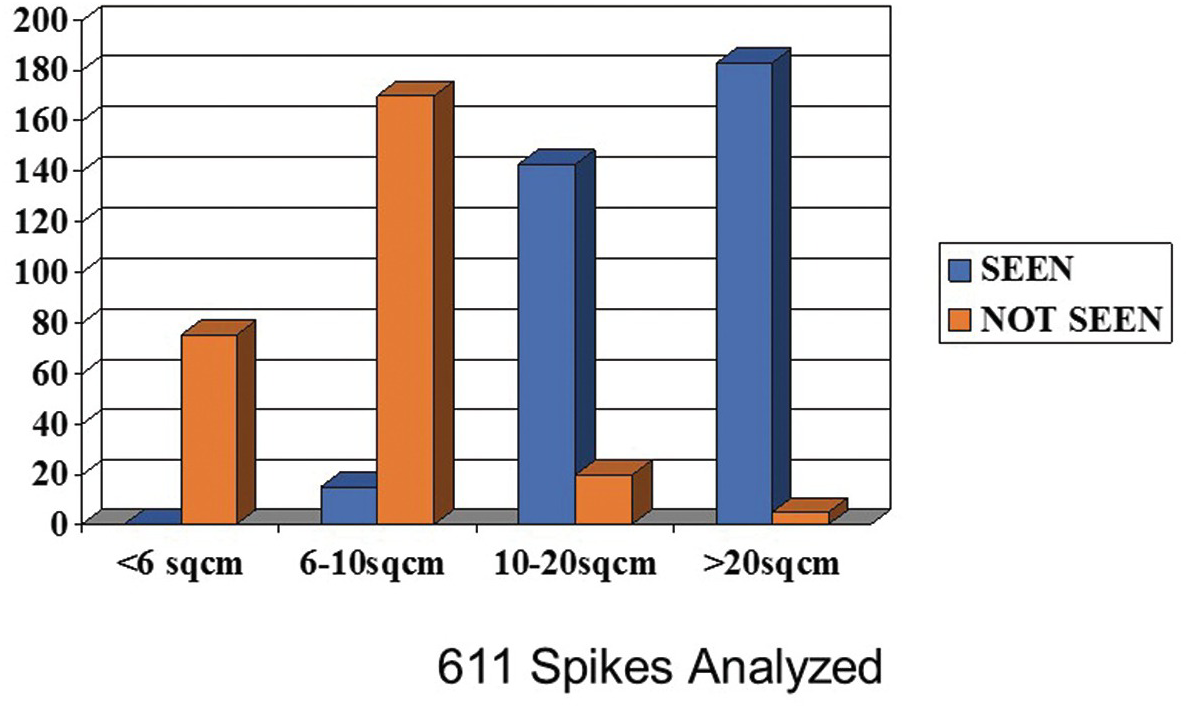 EEG Instrumentation and Basics (Chapter 11) - Understanding Epilepsy