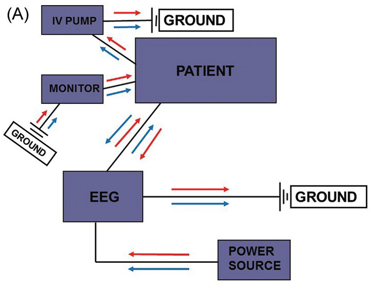 10 20 eeg hook up
