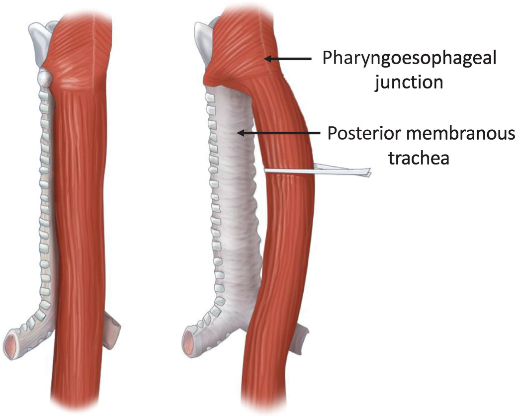 Anatomy of human trachea | Download Scientific Diagram