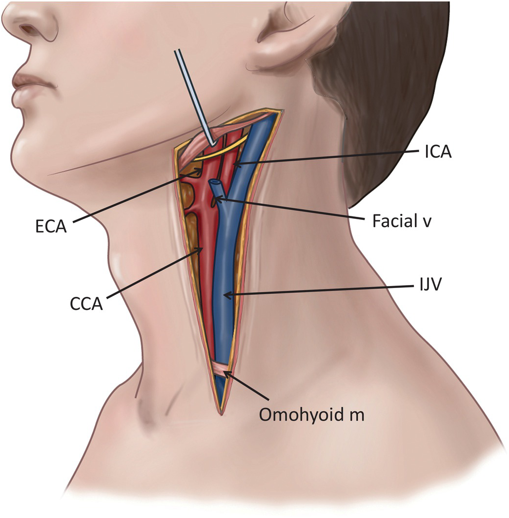 jugular vein and carotid artery