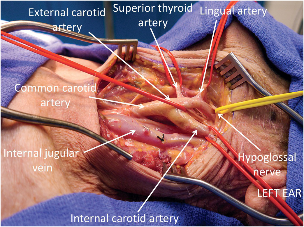 jugular vein and carotid artery