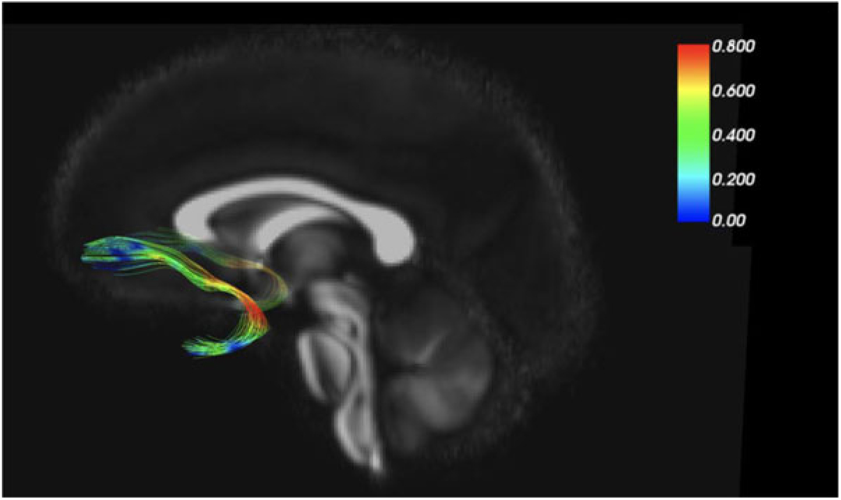 Longitudinal Research At The Interface Of Affective Neuroscience ...