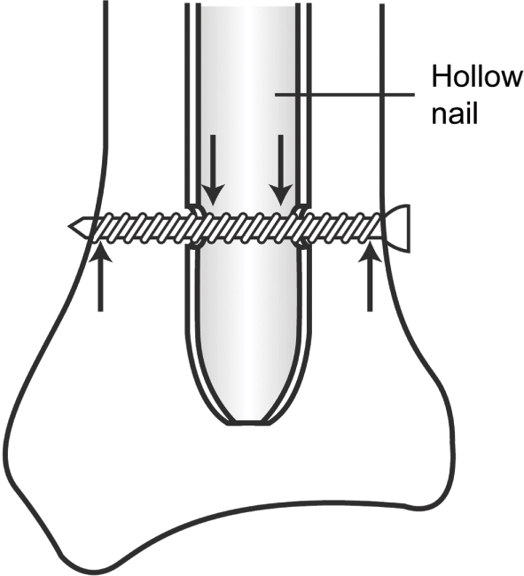 FREE CUSTOM SIZING! SCREW TOPS WOODWORKING TOOLS BLACK /& WHITE SCRUB HAT