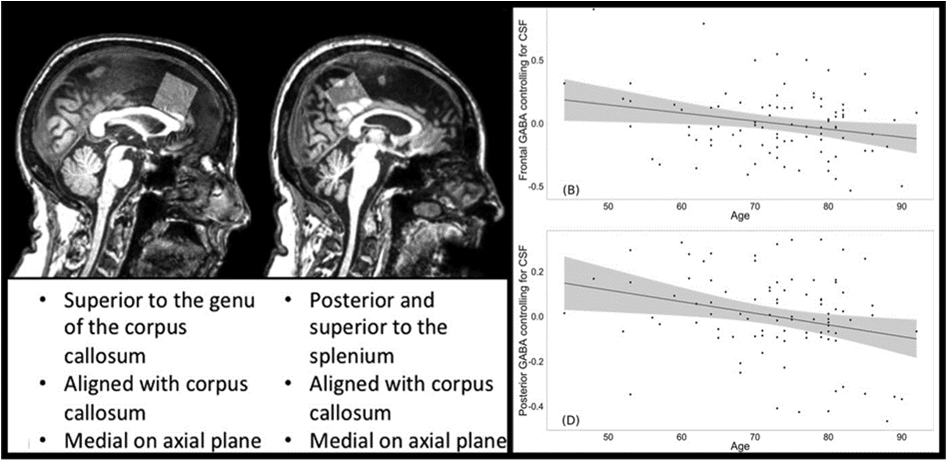 Neuroimaging of the Aging Brain (Chapter 4) - Cognitive Changes and the Aging Brain Neuroimaging of the Aging Brain (Chapter 4) - Cognitive Changes and the Aging Brain