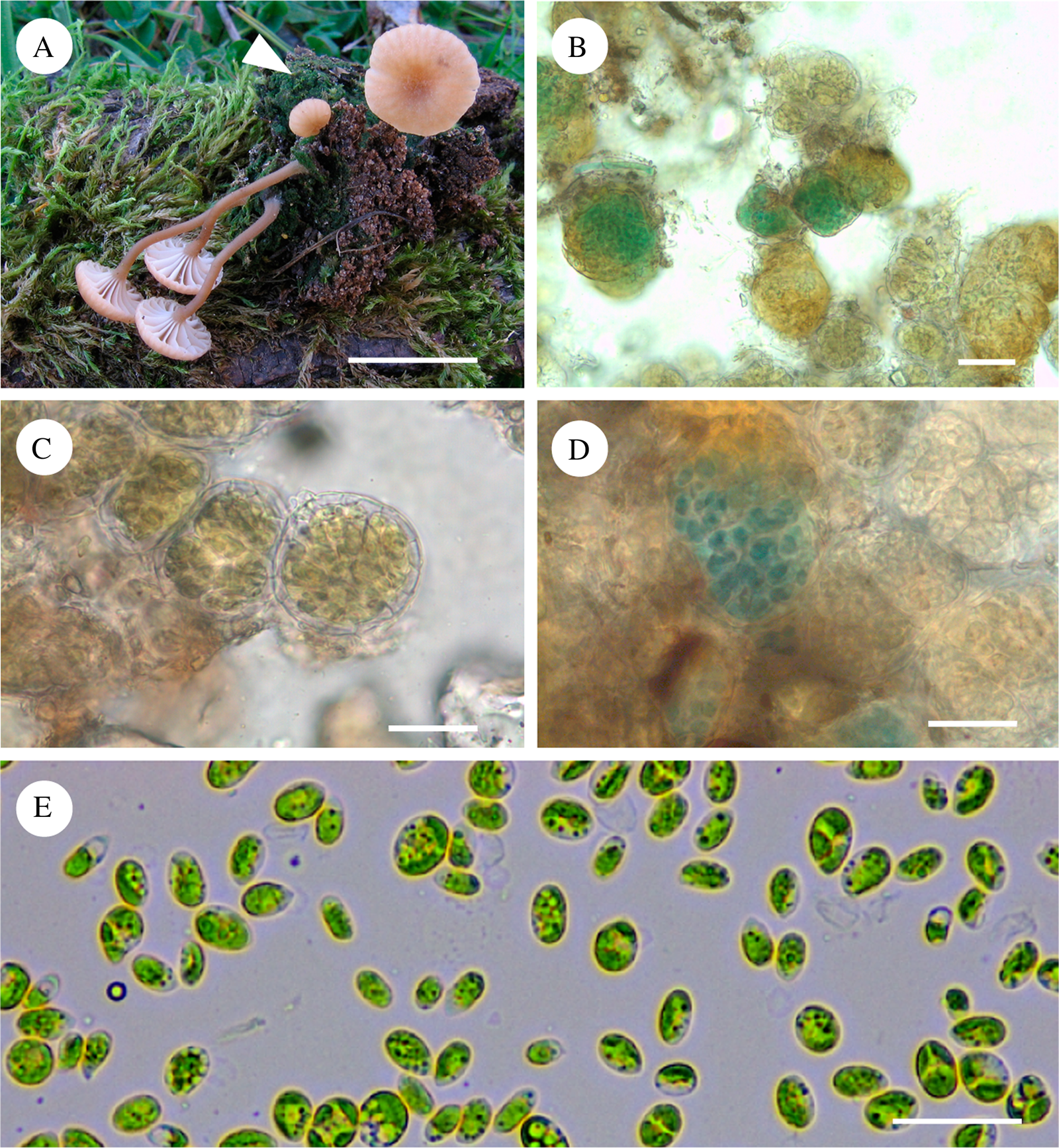 LMs of living cells showing chloroplasts. Fig. 1. Girdle view of