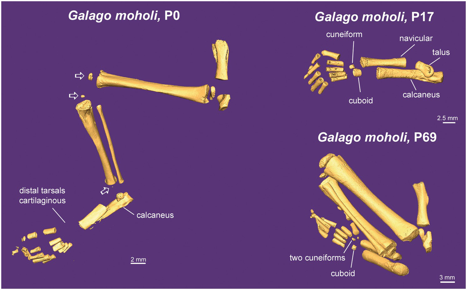 Pelvic girdle and hindlimbs of Barygenys maculata; (a, b, c) from