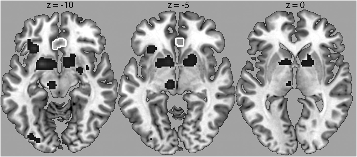 Validity of estimating IQ using chimp test and chess ELO - Psychiatry and  Psychology - Science Forums