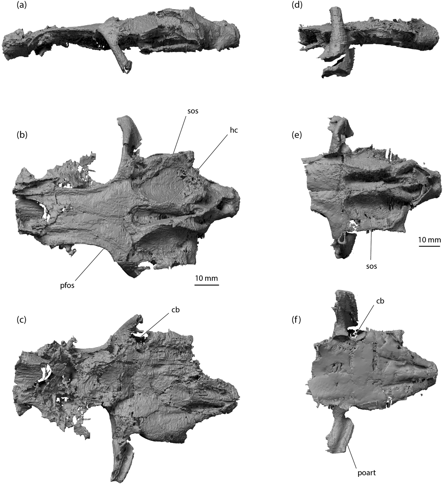 The neurocranium of the Lower Carboniferous shark Tristychius arcuatus ...