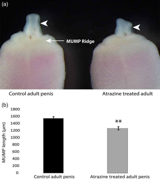 Atrazine induces penis abnormalities including hypospadias in mice