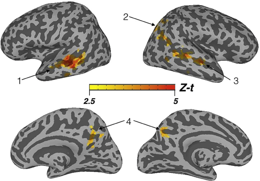 Figure 18