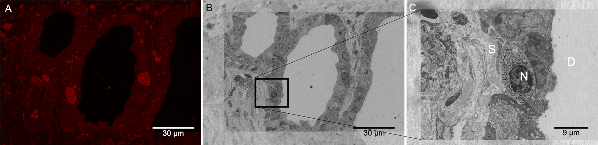 Electron Microscopy Sciences Diamond Scribing Tool Set of 6 Tools & Pin