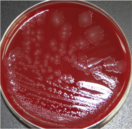 Epidemiological and genetic characterization of Clostridium butyricum ...