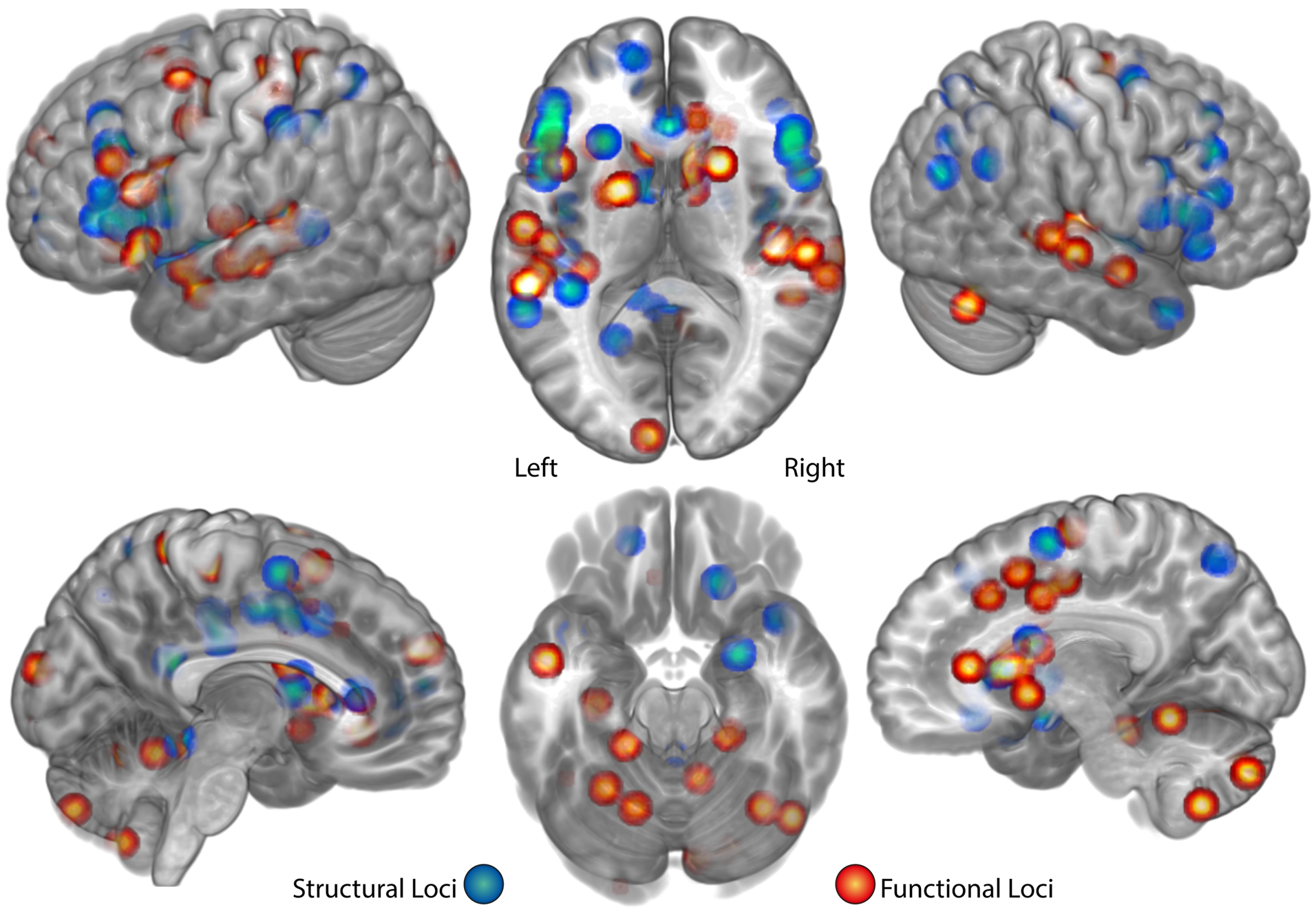 The neurobiology of simultaneous interpreting: Where extreme language ...