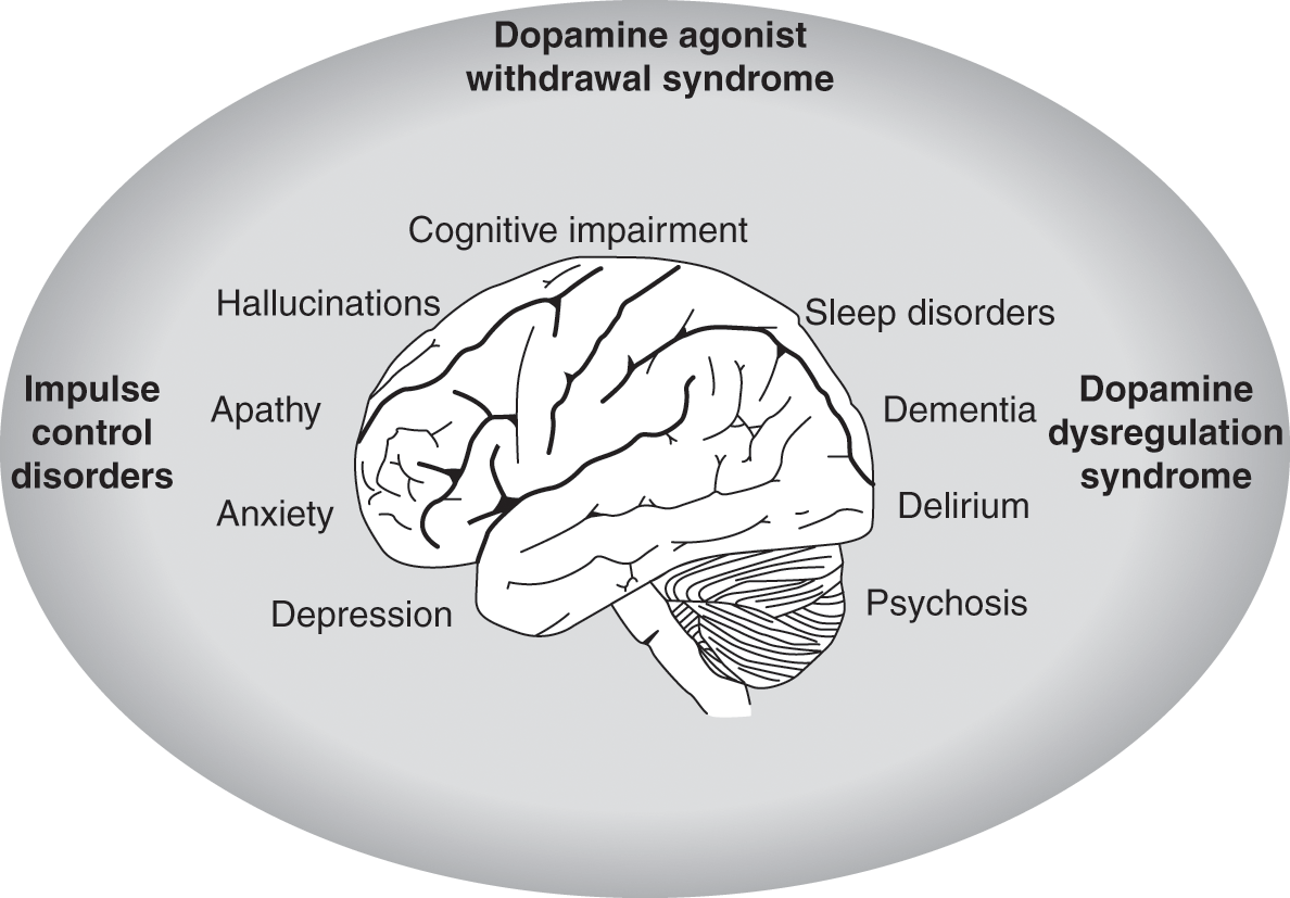 Mental Health in Parkinson s Disease Chapter 8 Clinical Topics