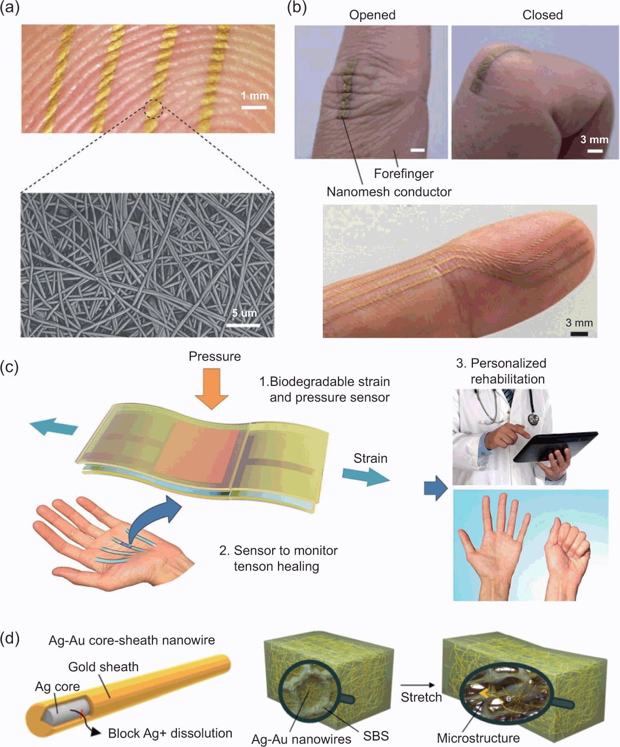 Highly Stretchy Black Gold E‐Skin Nanopatches as Highly Sensitive Wearable  Biomedical Sensors - Gong - 2015 - Advanced Electronic Materials - Wiley  Online Library