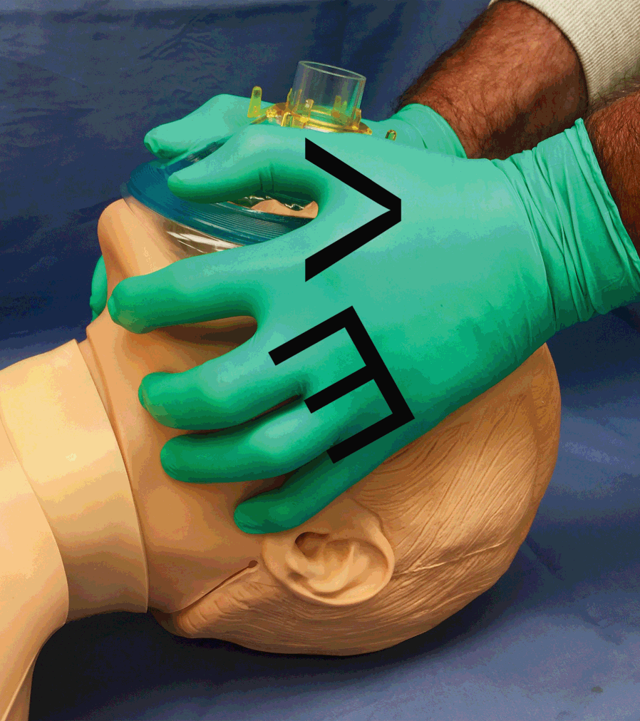 6 Ways To Be Better With The Bag-Valve-Mask - Critical Care Practitioner