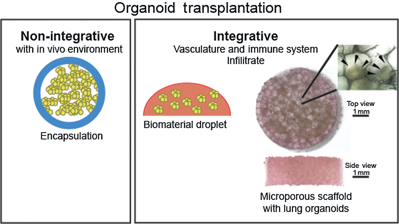 Take a deep breath and digest the material organoids and biomaterials