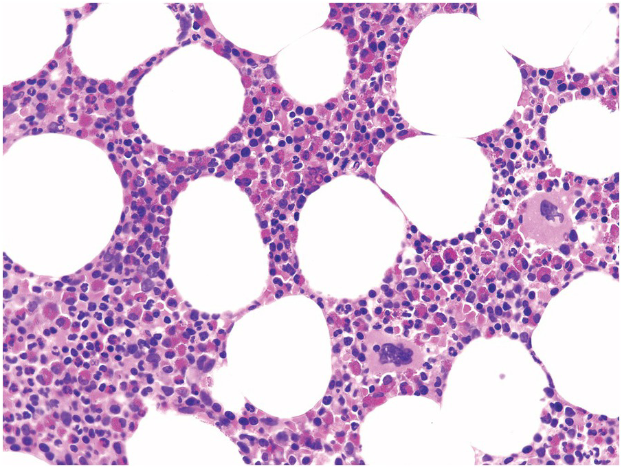 Bone Marrow Histology
