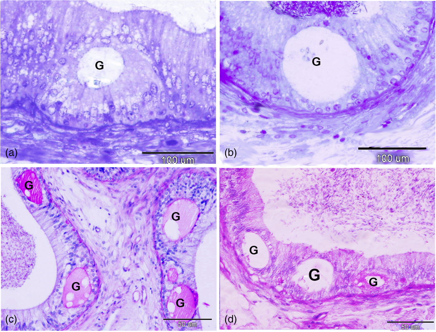 Seasonal Variation of the Intraepithelial Gland in Camel Epididymis ...