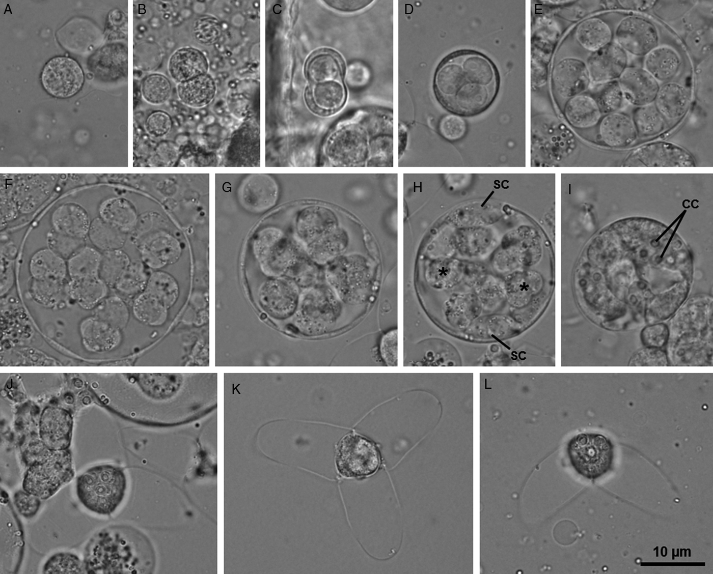 Molecular data infers the involvement of a marine aurantiactinomyxon in ...