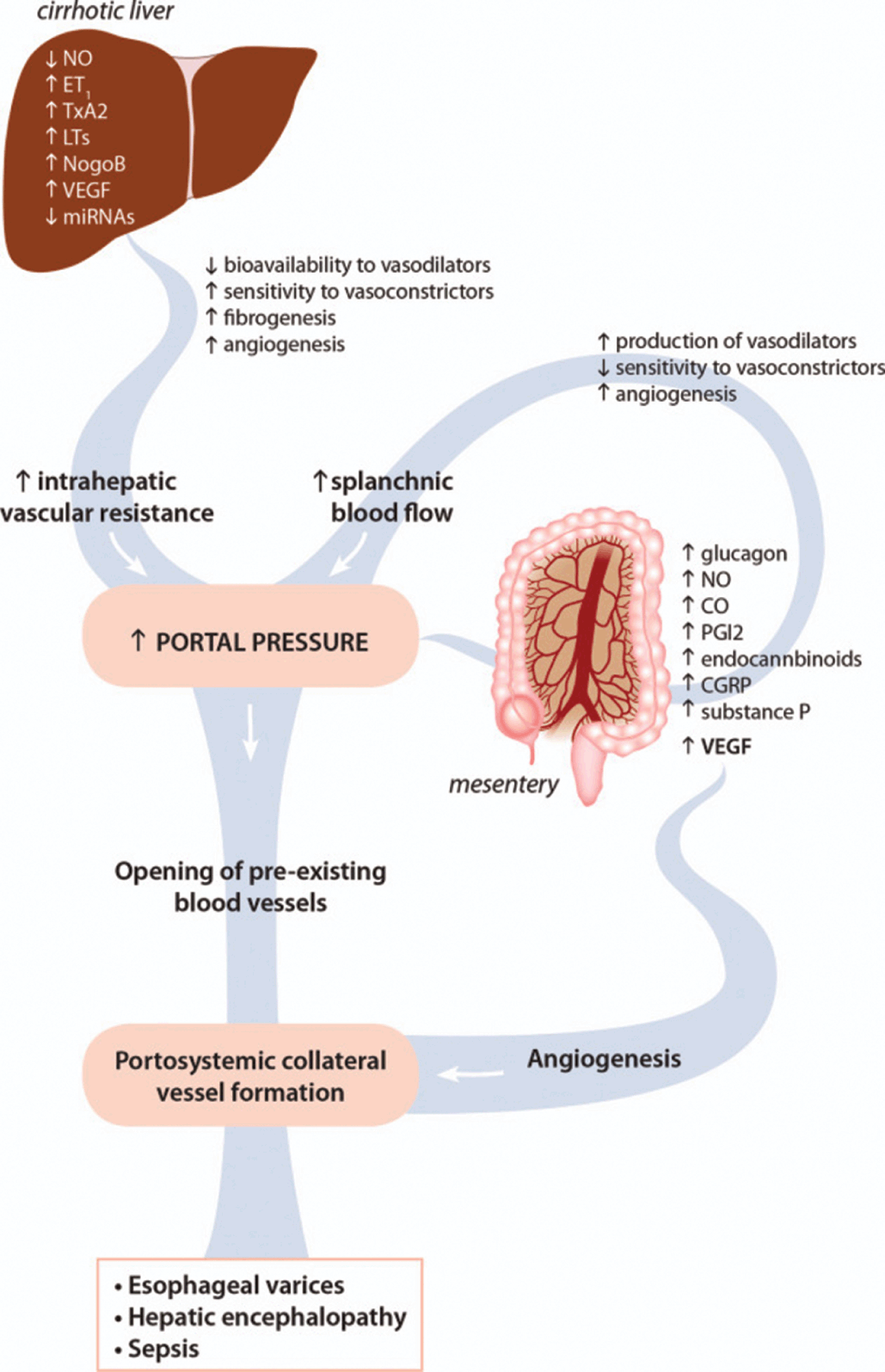 Portal Hypertension Pathophysiology