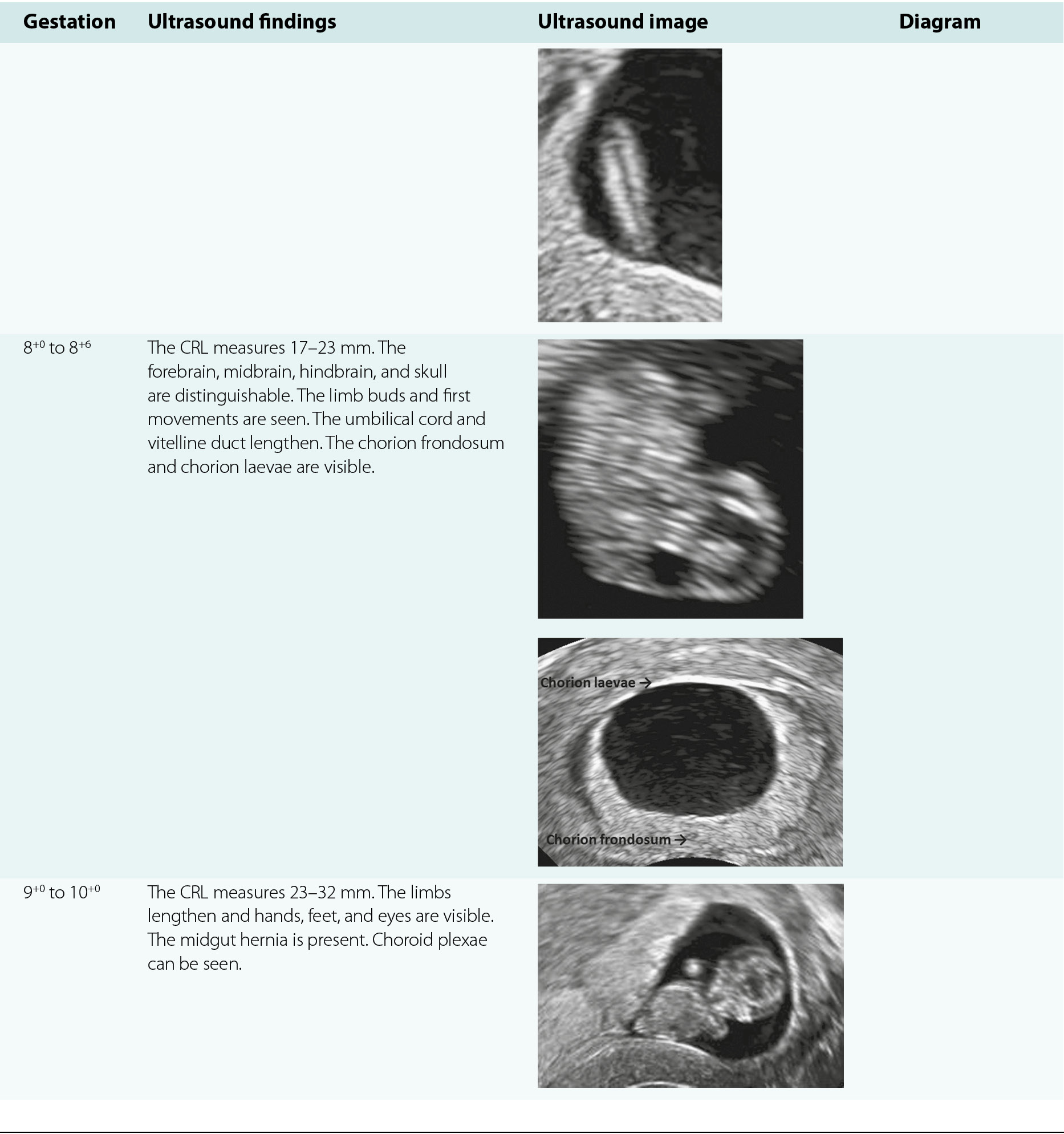 At 4 weeks pregnancy scan Anatomy scan