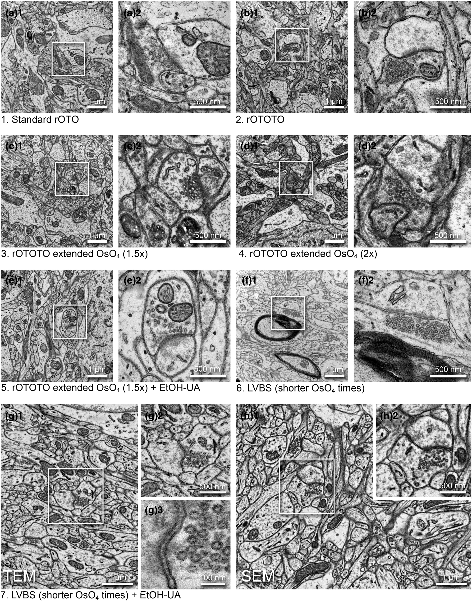 A high magnification image of synapse obtained by electron microscopy