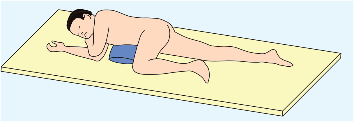 What is best for Pilonidal Sinus? Donut Pillow vs U-Shaped Pillow – Clevive