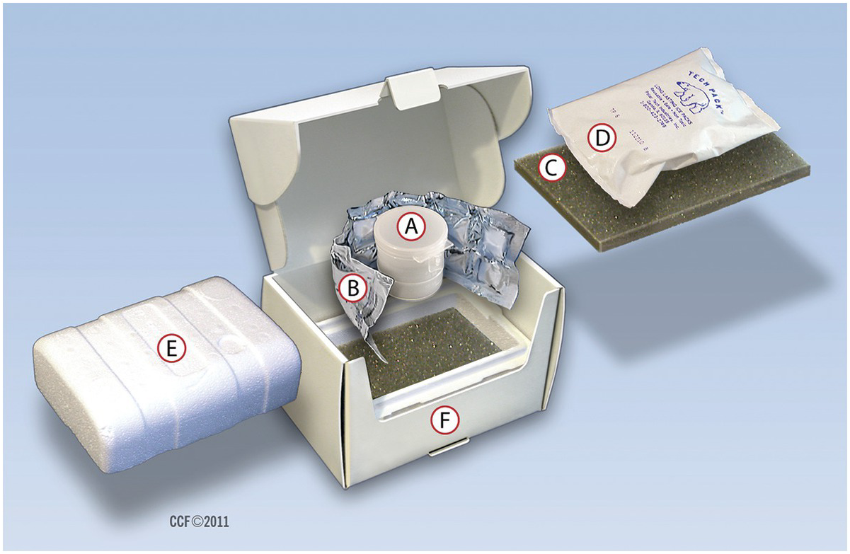 Cryochoice do sperm sample 2025 sent back include ice bags