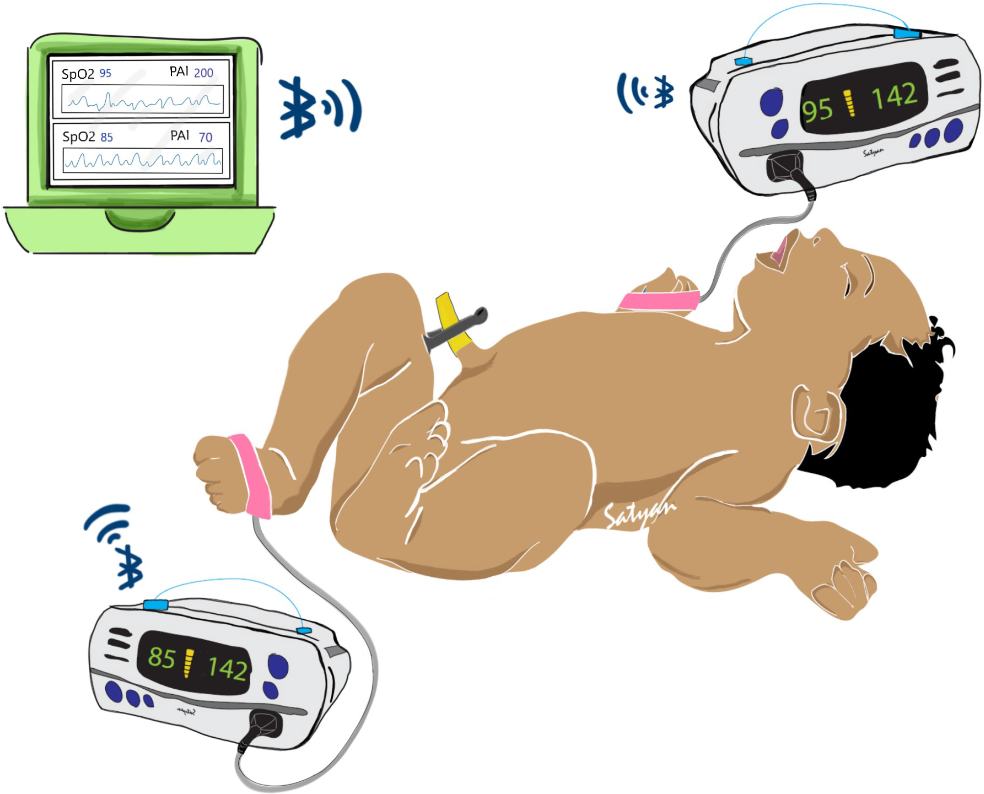 A novel system to collect dual pulse oximetry data for critical congenital  heart disease screening research | Journal of Clinical and Translational  Science | Cambridge Core