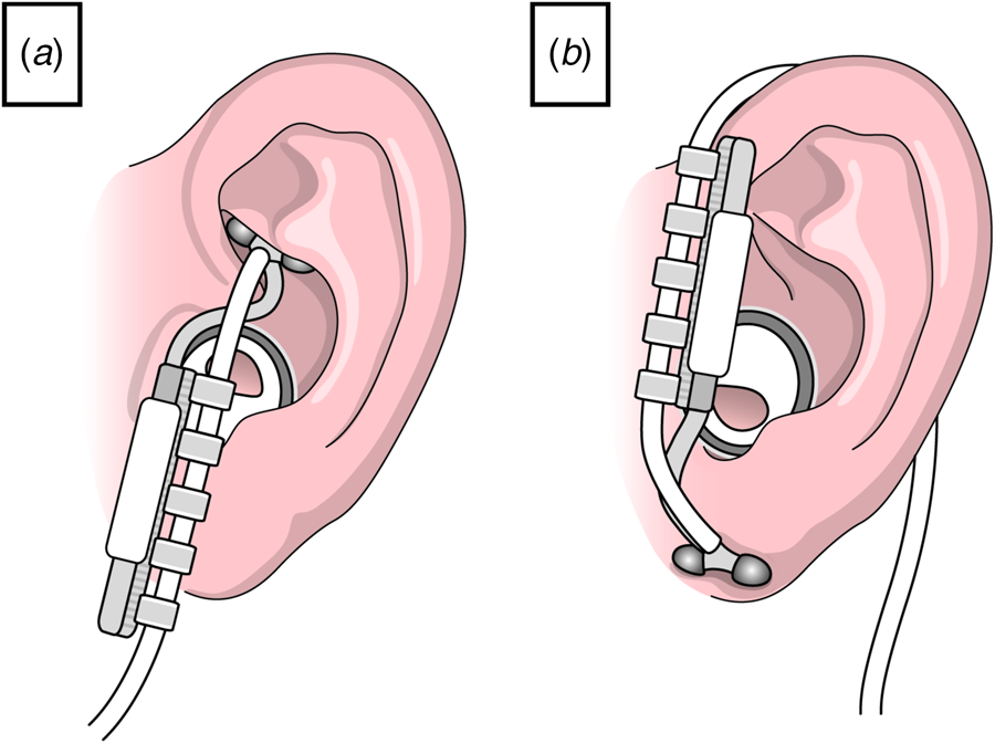 Frontiers  Critical Review of Transcutaneous Vagus Nerve