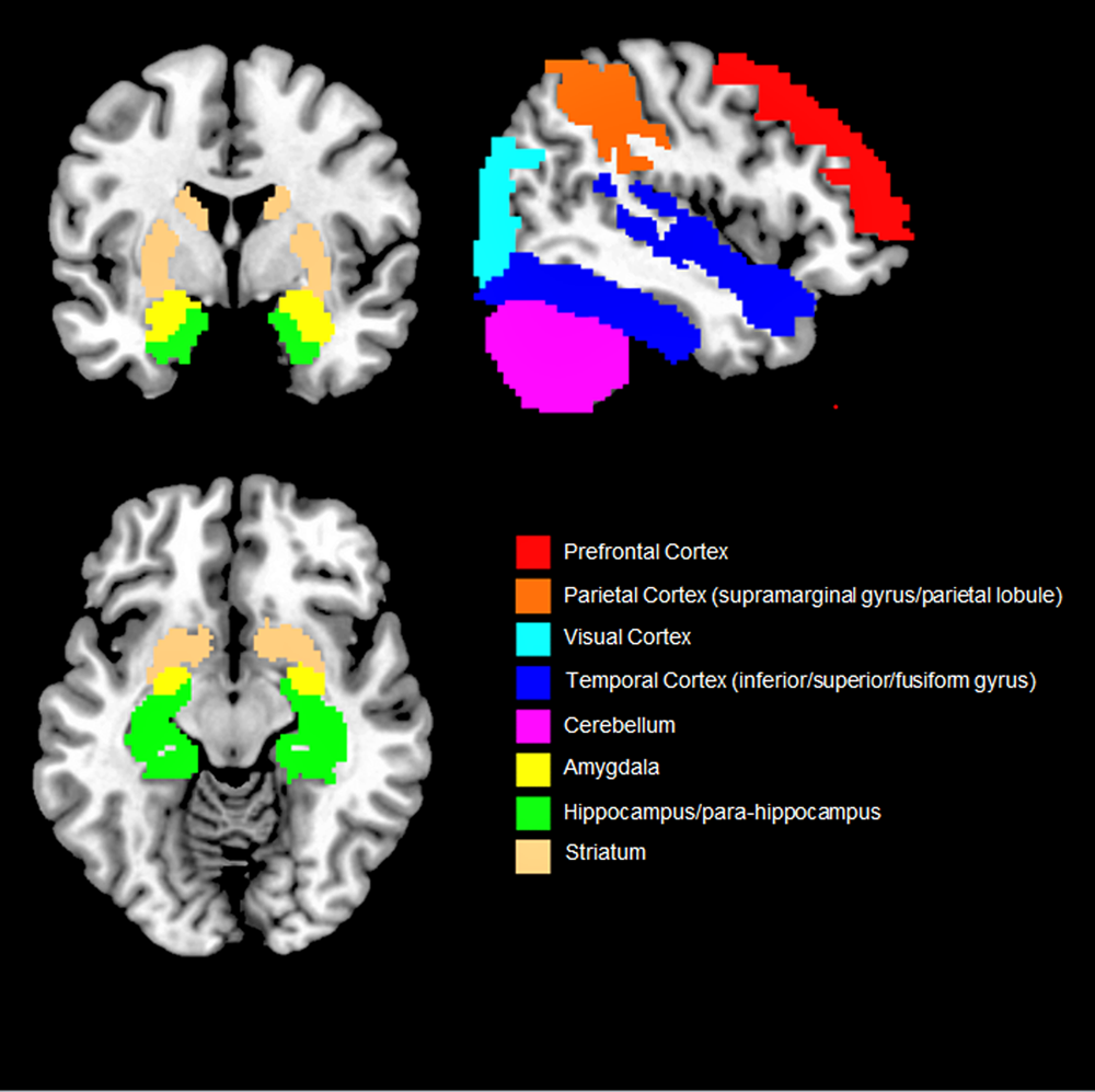 Locked Inside: The Neuroscience of Social Isolation